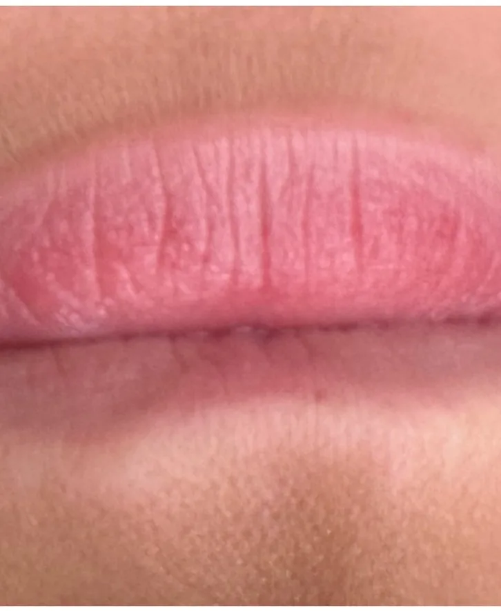 Pale, uneven lip colour before lip blush