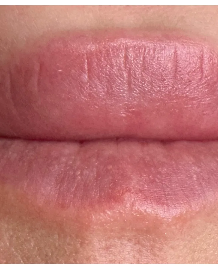 Lips that had lost their colour, before lip blush