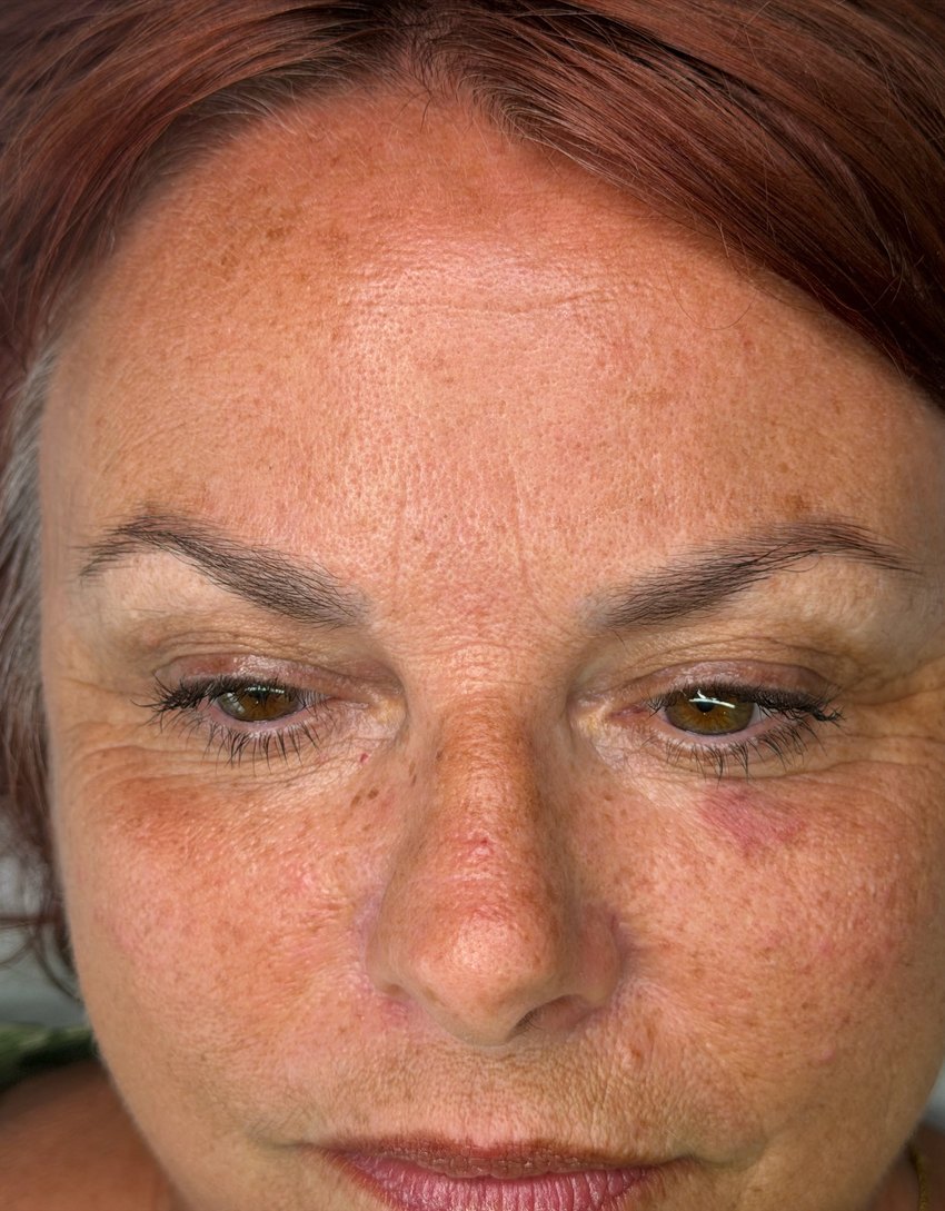 Faded, sparse eyebrows before treatment