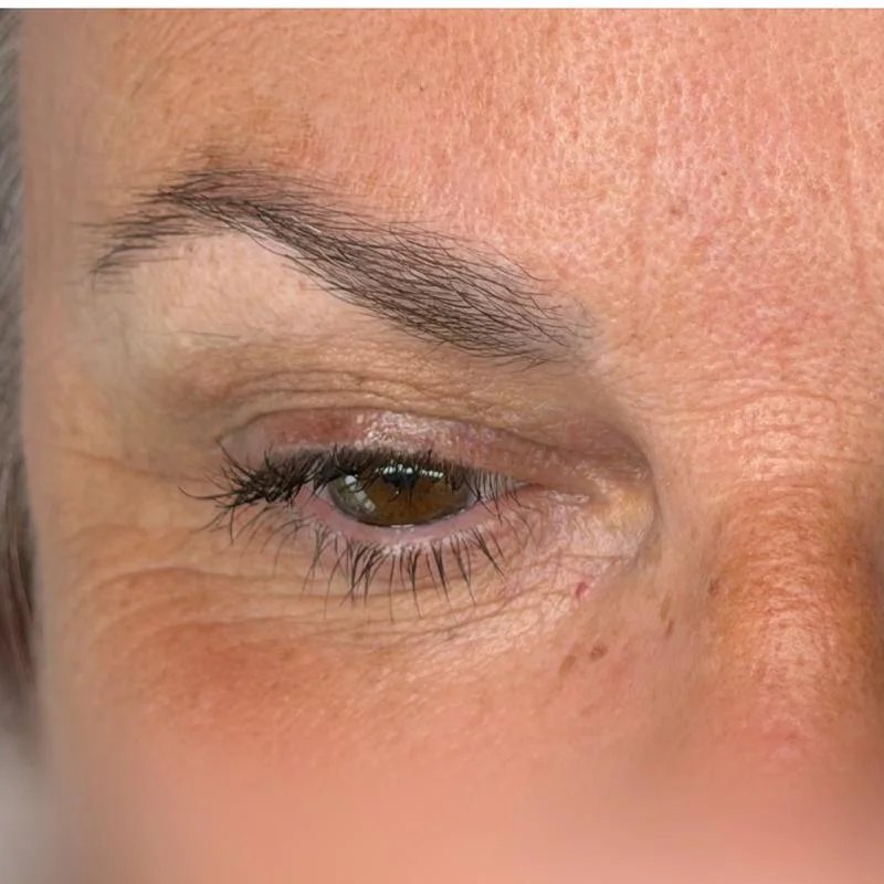 Over-plucked eyebrow before treatment