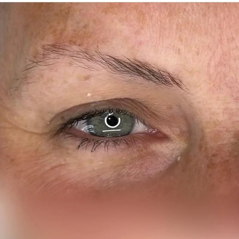 Thin eyebrow before enhancement