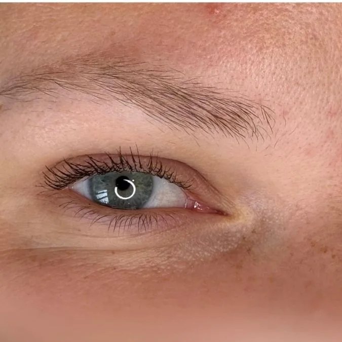 Fine, sparse eyebrow before enhancement
