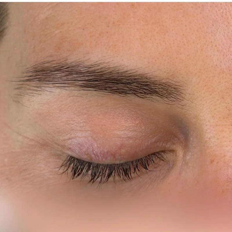 Sparse eyebrow before treatment